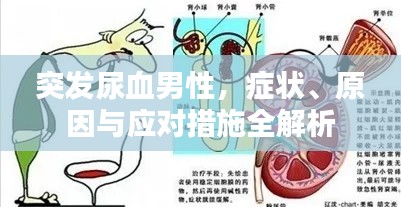 突发尿血男性，症状、原因与应对措施全解析